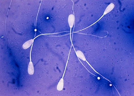Как выглядит здоровая сперма