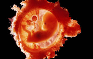 Как тромбофлибия влияет на беременность
